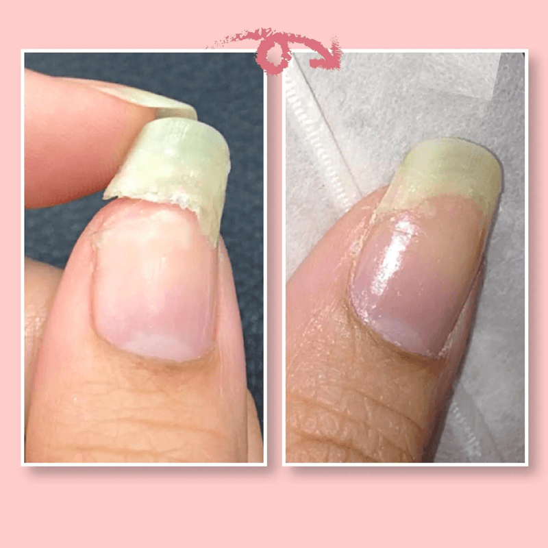 GEL DE PROTECTION POUR LA RÉPARATION DES ONGLES