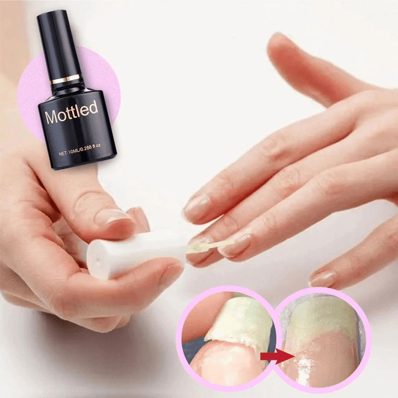 GEL DE PROTECTION POUR LA RÉPARATION DES ONGLES